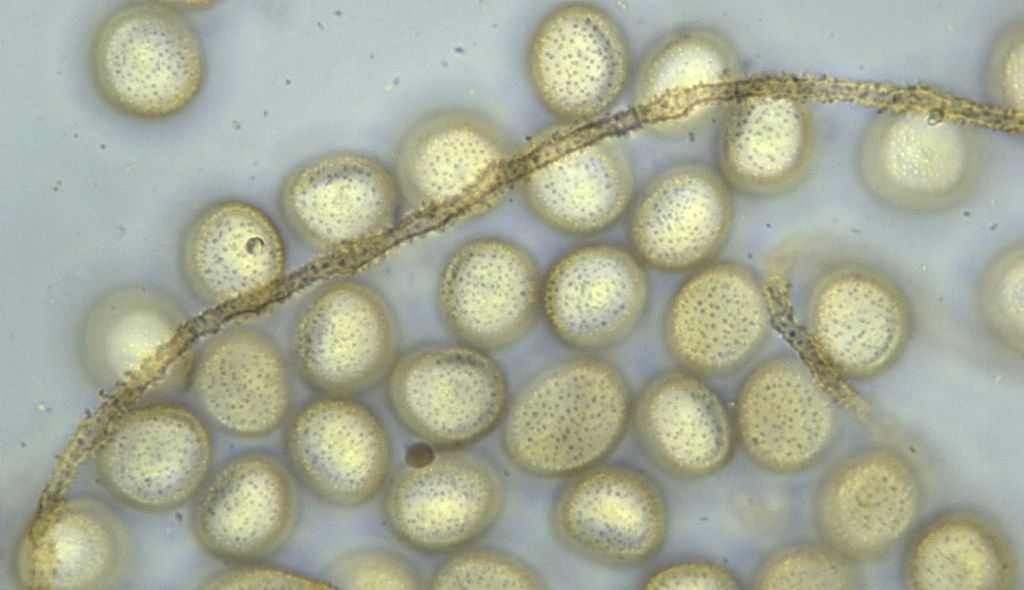 Perichaena depressa?